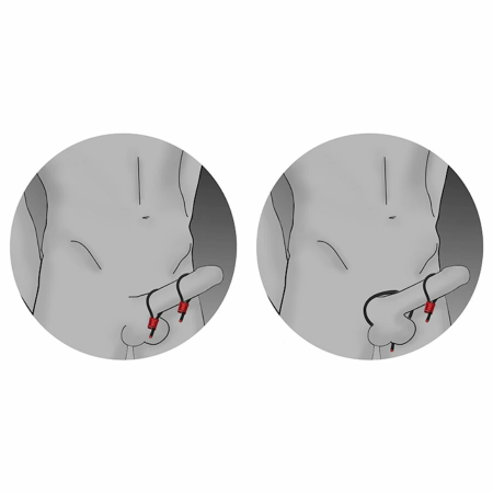 ElectraStim Prestige ElectraLoops Adjustable Black Rings, 2-Pack