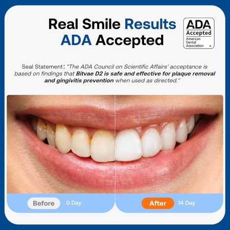 Elektrinis dantų šepetėlis Bitvae D2 juodas