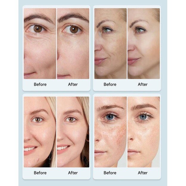 LED veido kaukė Reach FC1 4