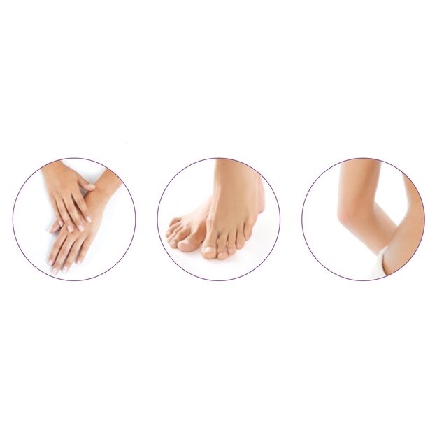 Medisana CR 860 Callus remover 1